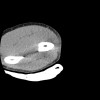 SPORK, NICO - 22.03.1976 - 02.08.2022 - CT obere Extremität - 17:56:57